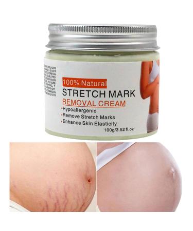 Cr me anti-vergetures de 100 g solution lissante absorption rapide hydratation de la grossesse pour les voyages les voyages d'affaires la maison un usage quotidien int rieur et ext rieur