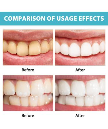 Renhe Artisan Fluoride-Free Probiotics Toothpaste | Fast Whitening & Protection | International Shipping - Buy Online on GoSupps.com