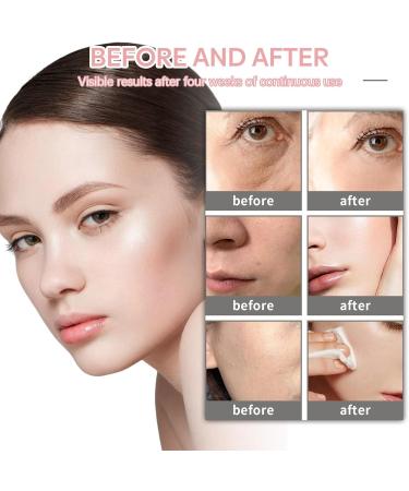 Skin Care Sets & Kits For Teenage Girls Gifts - 4 in 1 Skincare Sets Teen Skincare Set Pamper Sets For Women Gifts Hyaluronic Acid Skin Care Sets & Kits Face Serum Face Cream Face Mousse - Buy Online on GoSupps.com