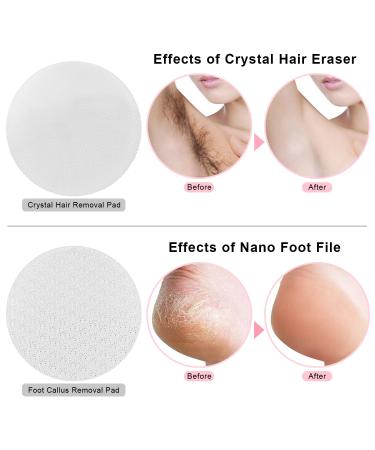 2 in 1 Electric Foot Callus Remover: Nano Crystal Hair Remover & Pedicure Foot File - Men & Women Feet Care Tool - Buy Online on GoSupps.com
