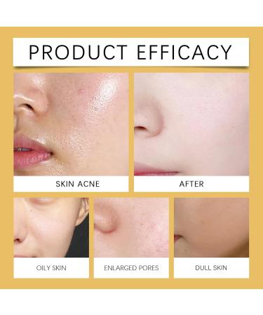  homomdy Peel Shot Rice Serum White and Black Rice Exfoliator Moisturizing Pore Minimizer Gently Remove Blackheads Gentle Exfoliating Serum for Face and Body (1white) - Buy Online on GoSupps.com