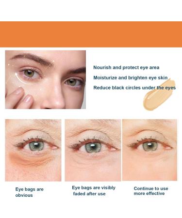 QGuoJie Lutein & Vitamin C Rollerball Eye Serum Oil AntiAging Essence for Dark Circles Puffy Eyes & Wrinkles Lightens Under Eye to Reduce Bags & Seize Serum 2 - Buy Online on GoSupps.com