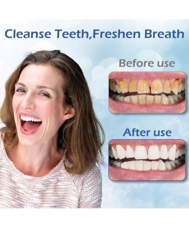 Hydroxyapatite Toothpastes for Enamel Protection and Tooth Strengthening, Gentle Mint, Safe for Sensitive Teeth, Daily Oral Care for Fresh Breath & Oral Health (3) - Buy Online on GoSupps.com