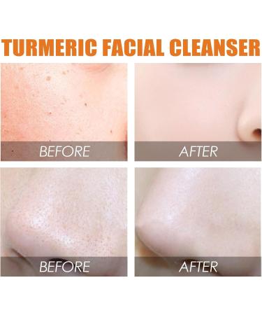 Turmeric Face Wash Face Wash for Dry Skin Turmeric Foaming Cleanser Exfoliating Face Wash Turmeric Glow Scrub Moisturising Face Wash Facial Cleanser Daily Makeup Brightening Foaming Face Wash - Buy Online on GoSupps.com