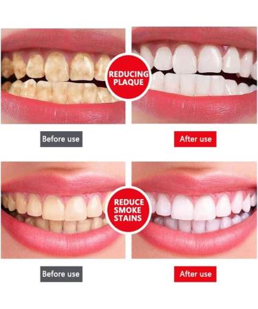Renhe Artisan Probiotic Toothpaste - Fluoride-Free Stain Removal & Whitening - Quick Fresh Lightening (1 Piece) - International Shipping Available - Buy Online on GoSupps.com
