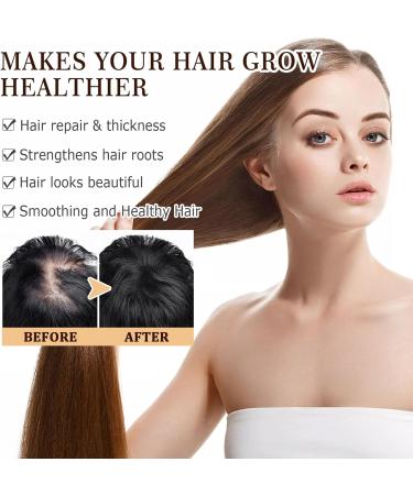 Rice Water for Hair Growth Rice Hair Care Set with Rice Water Shampoo Bar and Rice Water Spray Shampoo Soap for Hair Growth Nourishing Volumizing & Strengthening - Buy Online on GoSupps.com