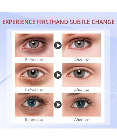 IZBEAUVO Under Eye Mask 10 PAIRS Collagen Eye Mask Collagen Hydrating Gel Pads Korean Eye Patches Hydrating Anti-Aging Anti Wrinkle Patches Removal Of Reducing Dark Circles Puffiness Wrinkles - Buy Online on GoSupps.com