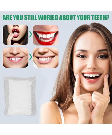 Temporary Tooth Repair Set - Degradable 25g Tooth Filling & Replacement for Missing Teeth | International Shipping Available - Buy Online on GoSupps.com