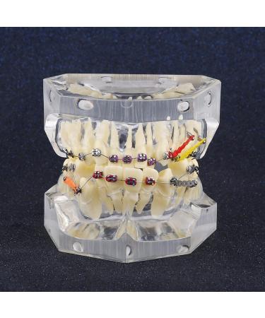 Tooth Model for Dentists & Orthodontists | Dental Orthodontic Study Model with Wire Chain for Painting Treatment - Buy Online on GoSupps.com