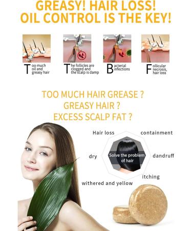 Ginger Hair Regrowth Shampoo Bar Ginger Shampoo Soap Ginger Shampoo Bar Solid Shampoo Bar (3pcs) - Buy Online on GoSupps.com