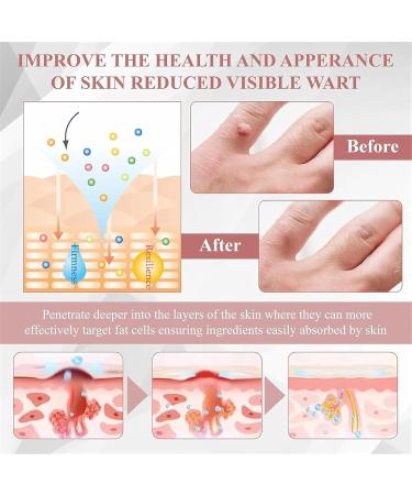 Masque gel peel-off anti-imperfections cr me de soin enrichie. Cr me claircissante pour une peau nette et un teint terne pour tous types de peau. 3pcs - Buy Online on GoSupps.com