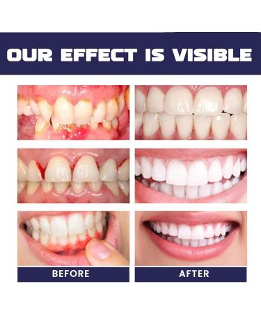 Koahde Gums Gel - Instant Gum Treatment & Therapy Gel | 2PC Gum Repair & Tooth Care Solution - Buy Online on GoSupps.com