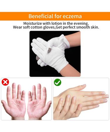 Molain Moisturizing Gloves & Socks Set for Overnight Eczema Healing and Spa Treatment - Buy Online on GoSupps.com