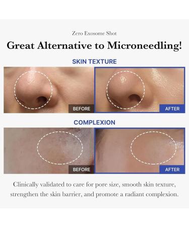 anti-aging & anti-spots Moisturizing facial serum enriched with hyaluronic acid - Anti-wrinkle firmness radiance facial treatment - With protective antioxidant complex - All skin types - 30 ml (1PCS) - Buy Online on GoSupps.com