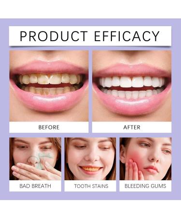 KLYso Oral Care Toothpaste - Gentle Cleaning Stain Removal Fresh Breath Teeth Protection & Whitening(1PCS) - Buy Online on GoSupps.com