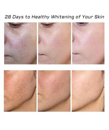 2 Pcs Whitening Freckle Cream Acne Scar Removal Treatment Cream Pigmentation Removal Cream for Face Moisturizing Removes Facial Melasma Dark Spots Wrinkles Blemishes (whitening freckle cream) - Buy Online on GoSupps.com