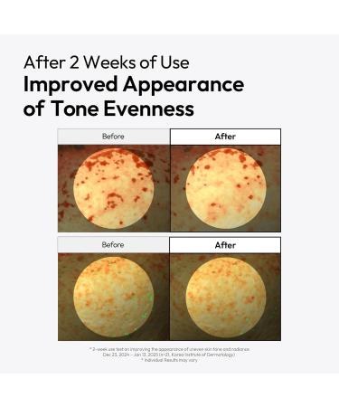 LAYERLAB Niacinamide 7% & Tranexamic Acid 3% Dark Spot Appearance Serum | 13% Radiance Complex Visibly Evens Skin Tone Look | Hydrating K-Beauty Skincare 0.94 fl.oz - Buy Online on GoSupps.com