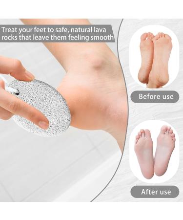 Pumice Stone Natural Pumice Stone Pumice Stone Foot Care Pumice Stone Callus Stone for Exfoliating and Removing Hard Dead Skin - 2 Pieces Comes with 2 Hooks - Buy Online on GoSupps.com