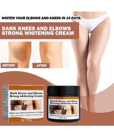 G neric Crema Para Manchas Oscuras En La Cara 1/2/3pcs 2026 New 50ml crema Para Las Manchas De La Cara Para Piel Entrepierna Manchas Codos Piernas Zonas Rodillas Cuello (1pcs) - Buy Online on GoSupps.com