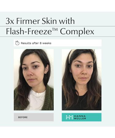 Dark Circle and Puffiness Eye Gel - Fine Lines & Wrinkle Treatment - 15ml - Buy Online on GoSupps.com