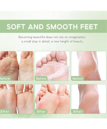 Tea Tree Oil Foot Cream Foot Balm for Cracked Dry Feet Athletes Foot Nail Fungus Hydrates and Moisturizes Callused Feet - Heel Cream All Natural Foot Cream Hand Cream - Helps Soothe Irritated Skin - Buy Online on GoSupps.com