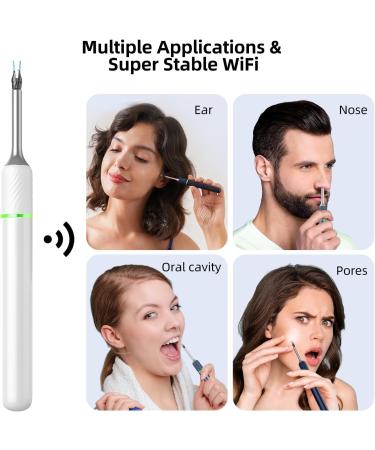 Wireless Ear Wax Removal Kit with 1920P FHD WiFi Camera | Ear Cleaner for Adults, Kids, Pets | Visual Otoscope Endoscope for iOS Android | Includes Ear Pick & Tweezers - White - Buy Online on GoSupps.com