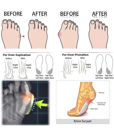 EEUK Orthopedic Women's Dressy Summer Sandals - Comfortable Flat Leather Slippers in Black - 42 EU - Buy Online on GoSupps.com