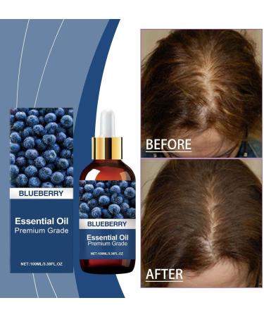 Rubu22a Rosemary oil blueberry hair oil suitable for women and men pure natural cosmetics for hair and scalp nourishing scalp treatment 100 ml 033 ml 300er Pack - Buy Online on GoSupps.com