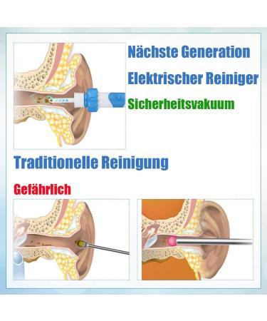 Q Grips Ear Wax Remover - Electric Ear Cleaner with 2 Washable Heads | Family Safe Ear Wax Removal Tool - Buy Online on GoSupps.com