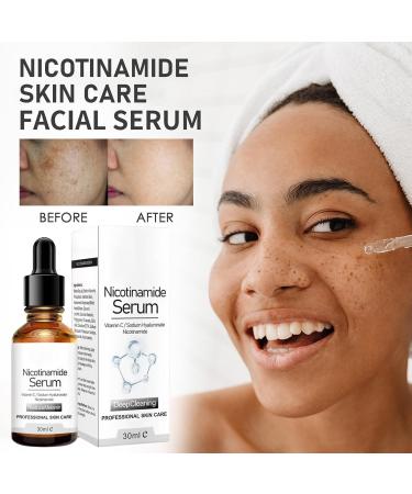 Niacinamide Serum - Dark Spot Remover for Face - Nicotinamide Face Moisturizer for Women - Reduce Melanin Dullness Restore Radiance - Moisture Hydrate Smooth Tender - Firm Lift Shrink Pore Elasticity - Buy Online on GoSupps.com