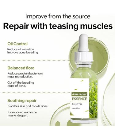 Acne Repair Face Serum Firming Serum For Face Green Tea Hyaluronic Acid Serum Relieve Redness & Acne Natural Face Serum For Acne Day & Night Serum For Face Hydrating Face Oils And Serums-Repair - Buy Online on GoSupps.com