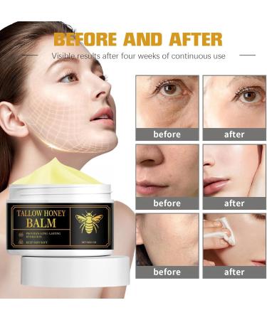 Tallow Honey Balm Moisturiser for Dry Skin Tallow Honey Balm Body Lotion Tallow Moisturiser Firming Face Cream Face Moisturiser Moisturiser Face Women Face Care Face Cream Facial Moisturizer - Buy Online on GoSupps.com
