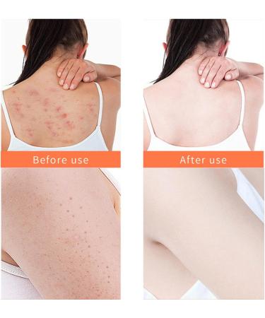 Hocossy Turmeric Body Scrub - 150ML for Acne, Dark Spots, Hyperpigmentation, and Smooth Skin - Buy Online on GoSupps.com