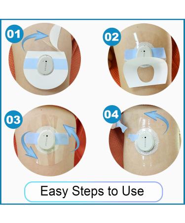 Dexcom G7 Adhesive Patches 45-Pack - Waterproof, Latex-Free & Long Lasting | Easy Application, Breathable & Skin Friendly - Blue - Buy Online on GoSupps.com