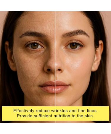  KOSLEOW 2 PCS Anti-Wrinkle Eye Contour Cream with Retinal Probiotics and 5% Caffeine Intense Moisturizer to Reduce Dark Circles Puffiness and Fine Lines 40ml - Buy Online on GoSupps.com