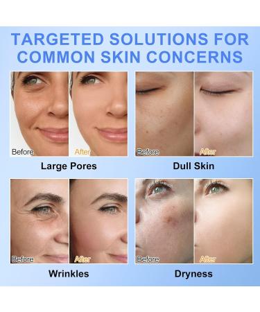 Masque Collagene 6 Pi ces - Masque Anti-Rides au Collag ne Profond pour Tous Types de Peau R duction des Pores Am lioration de l' lasticit  - Buy Online on GoSupps.com