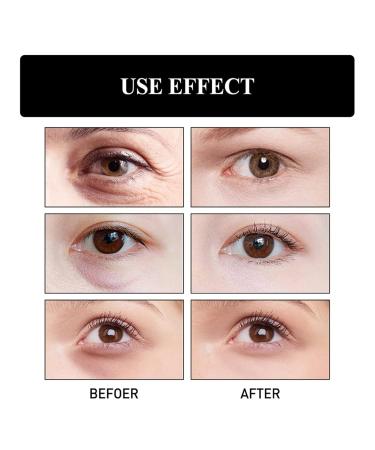 4-Piece Jysuing Snake Venom Peptide Eye Cream Set - Brightening Anti-Wrinkle & Dark Circle Treatment - Buy Online on GoSupps.com