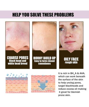 30% AHA+ 2% BH_A Face Serum BH_A Exfoliating Solution Target Breakouts by Helping to Reduce Blemishes Pores & Blackheads for A Cleaner More Radiant Complexion - Buy Online on GoSupps.com