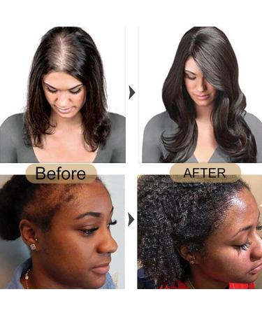 Doctor Truth Batana Oil for Hair Growth - 100% Organic & Unrefined Natural Oil for All Hair Types - Buy Online on GoSupps.com