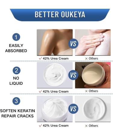 42% Urea Cream - Cracked Heel Repair Cream - Urea Foot Cream for Cracked Heels and Dry Skin - Foot Cream - Skin Care for Feet Heels Hands Knees Legs Toenails - Foot Moisturiser - Buy Online on GoSupps.com