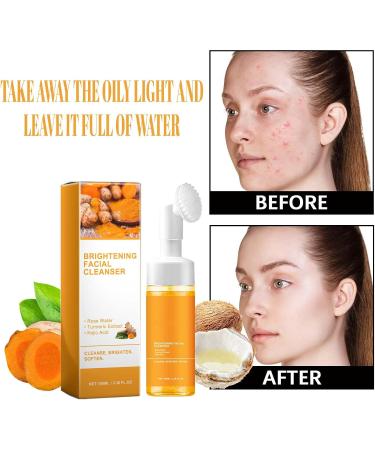 Turmeric Facial Cleanser Turmeric Face Wash Turmeric Kojic Acid Foaming Cleanser Brightening Foaming Face Wash Turmeric Foaming Facial Cleanser For face and body cleansing (1PC) - Buy Online on GoSupps.com