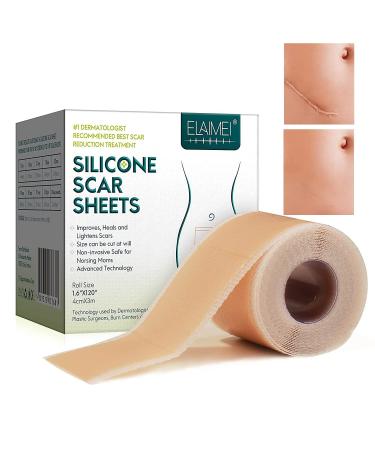 Silicone Scar Sheets,Silicone Scar Tape Roll 1.6”x 120”(8 Month Supply),Soft Silicone Gel Scar Tape,Reusable And Effective Scar Removal Sheets Scar Strips For C-Section & Keloid Surgery, Burn, Acne