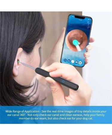 Earwax Removal Kit with Otoscope 1080P | Silicone Ear Scoop Vacuum Cleaner Tool with LED Light | Smart Visual Ear Sticks | Health Care Ear Cleaner for Adults and Kids - White - Buy Online on GoSupps.com