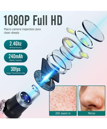 Blackhead Remover Tools with Camera | Pore Cleaner Kit for iPhone, iPad & Android | 20X Magnification | Visible Results - Buy Online on GoSupps.com