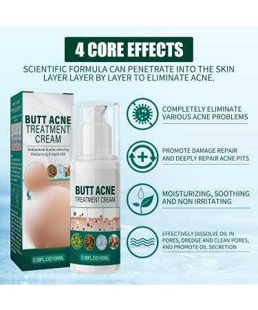 Shantou Yingji Acne cream for buttocks - Buy Online on GoSupps.com