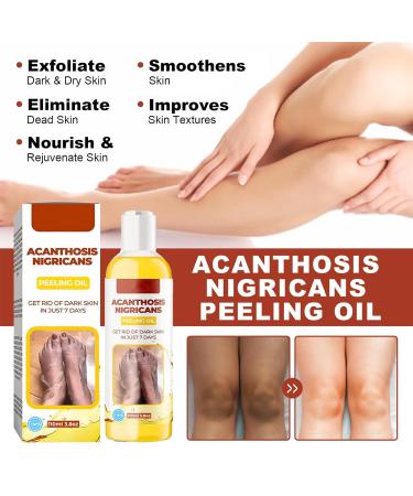 Extra Strong Peeling Oil - Chemical Exfoliant for Face & Body | Reduces Wrinkles Stretch Marks & Dead Skin - Buy Online on GoSupps.com