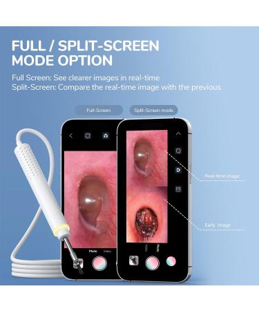 ScopeAround Otoscope for iPhone - 3.9mm Ultra-Thin Ear Camera with 6 LED Lights - Ear Wax Removal Kit - Specula Protection - Compatible with iPhone/Android - No WiFi Needed - Buy Online on GoSupps.com