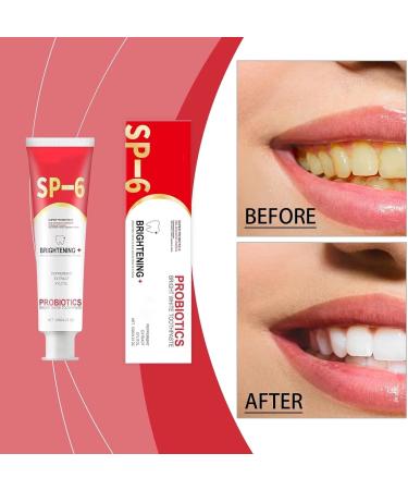 SP-6 Ultra Whitening Toothpaste - Brightening Stain Removing & Fresh Breath Formula - International Shipping Available - Buy Online on GoSupps.com