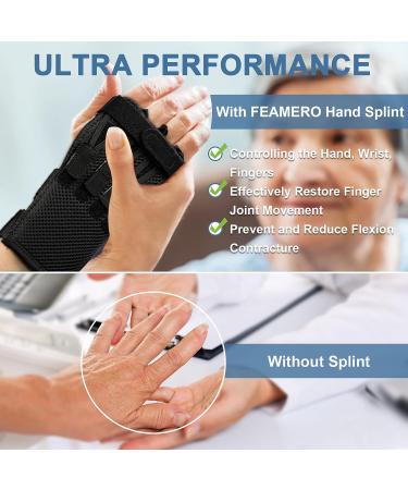 Feamero Radial Nerve Palsy Splint - Adjustable Finger Lift Arm Brace for Drop Wrist & Nerve Injury - Unisex Fit - Left & Right Hand - Buy Online on GoSupps.com