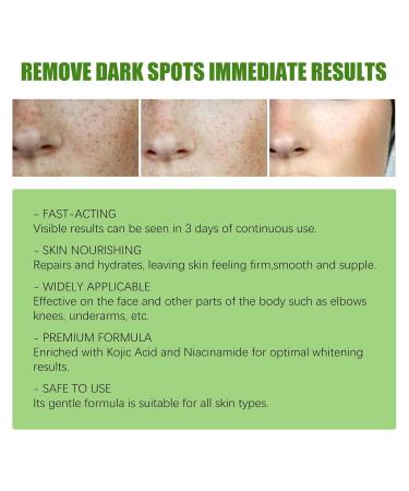 G neric 1/2/3/5pcs Crema Para Manchas Oscuras En La Cara 2026 New Crema Para Las Manchas De La Cara Para Piel Entrepierna Manchas Codos Piernas Zonas Rodillas Cuello 30ml (3pcs) - Buy Online on GoSupps.com